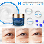 Nourishing Bo Uric Acid Lotion Moisturizing VC Eye Cream - Plush Fashion Hub